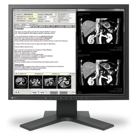 EIZO RadiForce MX194 19" Class SXGA LCD Monitor - 5:4 - Black